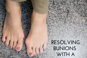 Resolving Bunions Through Bunionectomy: Restoring Comfort and Mobility